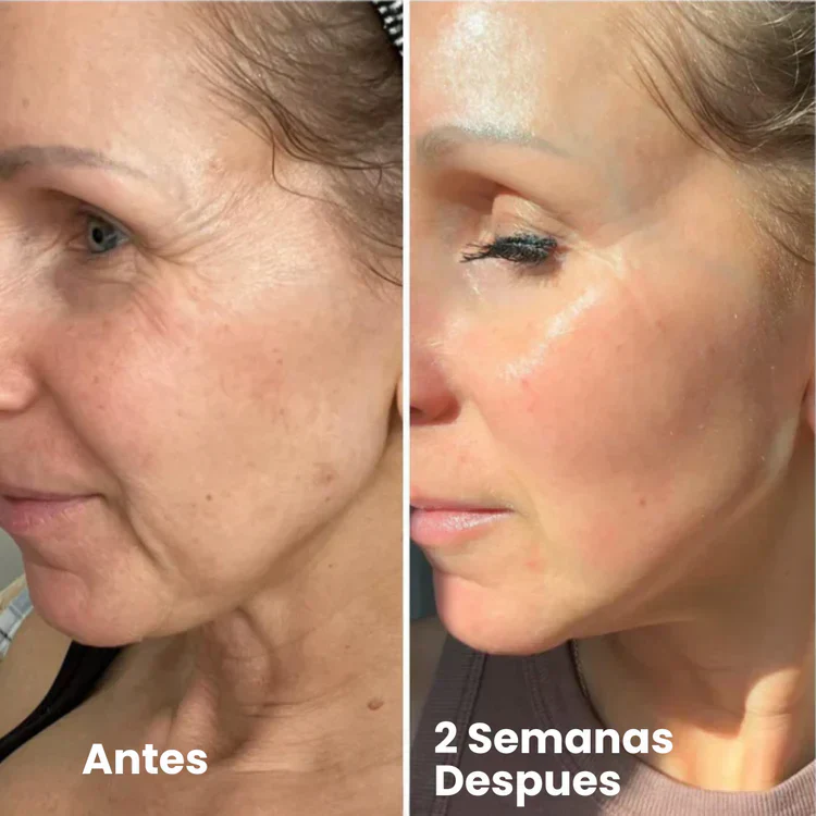 SkinLift | Advanced Retinal